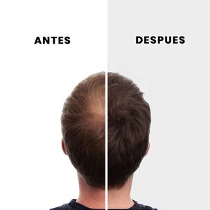 Nano Hair 4 Recargas 50 Grs C/u Pelo En Polvo Castaño Medio