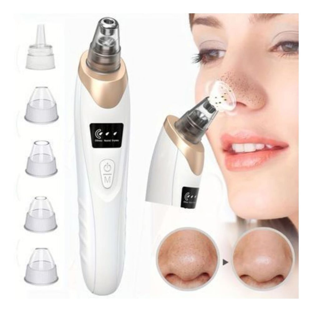 Extractor De Puntos Negros image number 0.0