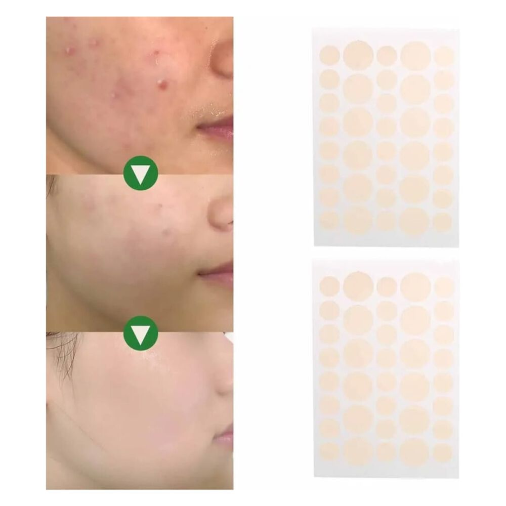 Parches Anti - Acné Ultra Delgados image number 0.0