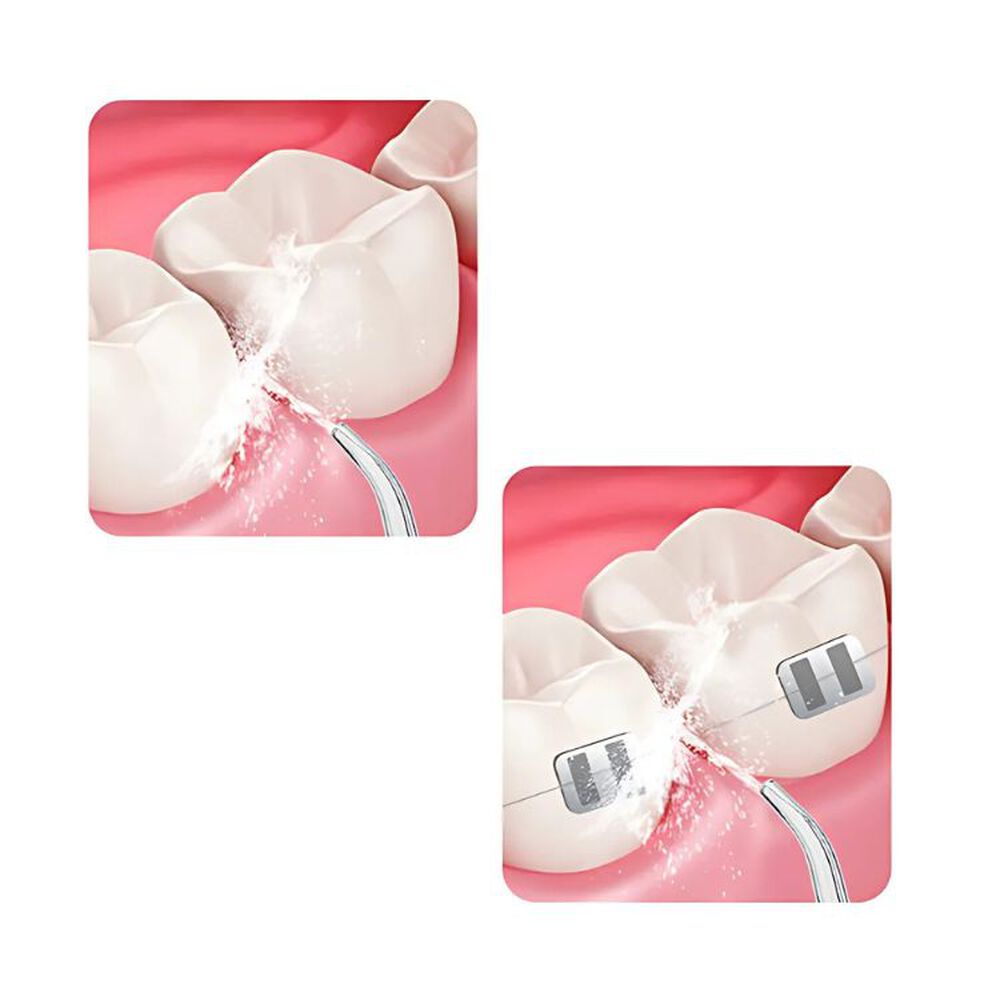 Limpiador Dental Portatil Usb Irrigador Bucal image number 5.0
