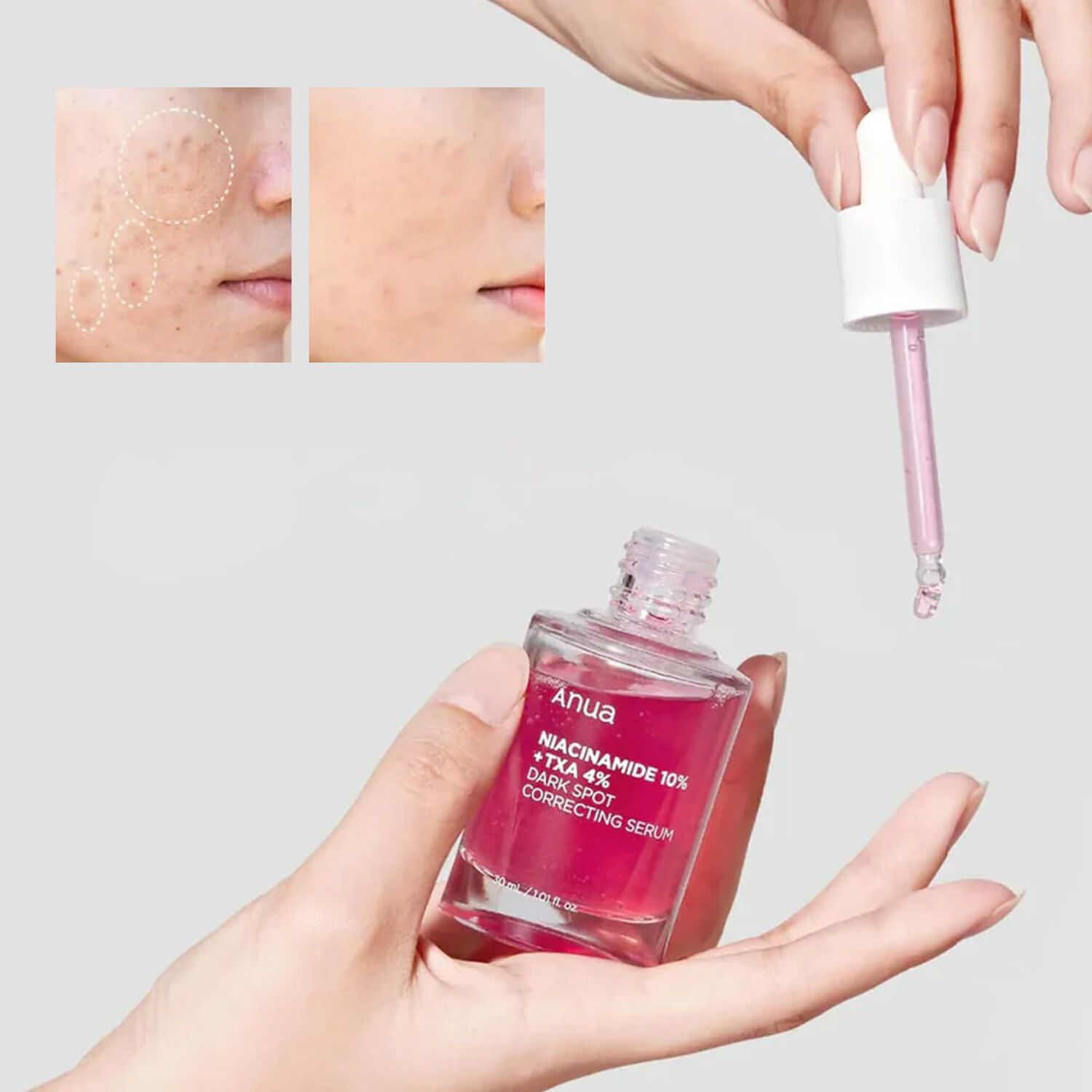 Niacinamide 10%+ Txa 4% Dark Spot Correcting Serum (anua) - 30ml Serum Aclarante 10% Niacinamida 4% &Aacute;cido Tranex&aacute;mico Y 2% Arbutina image number 1.0