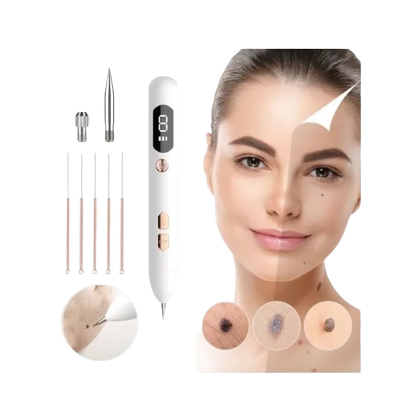 Removedor Acne Puntos Negros 5 Agujas 17cm Mole Spot Beauty image number 0.0