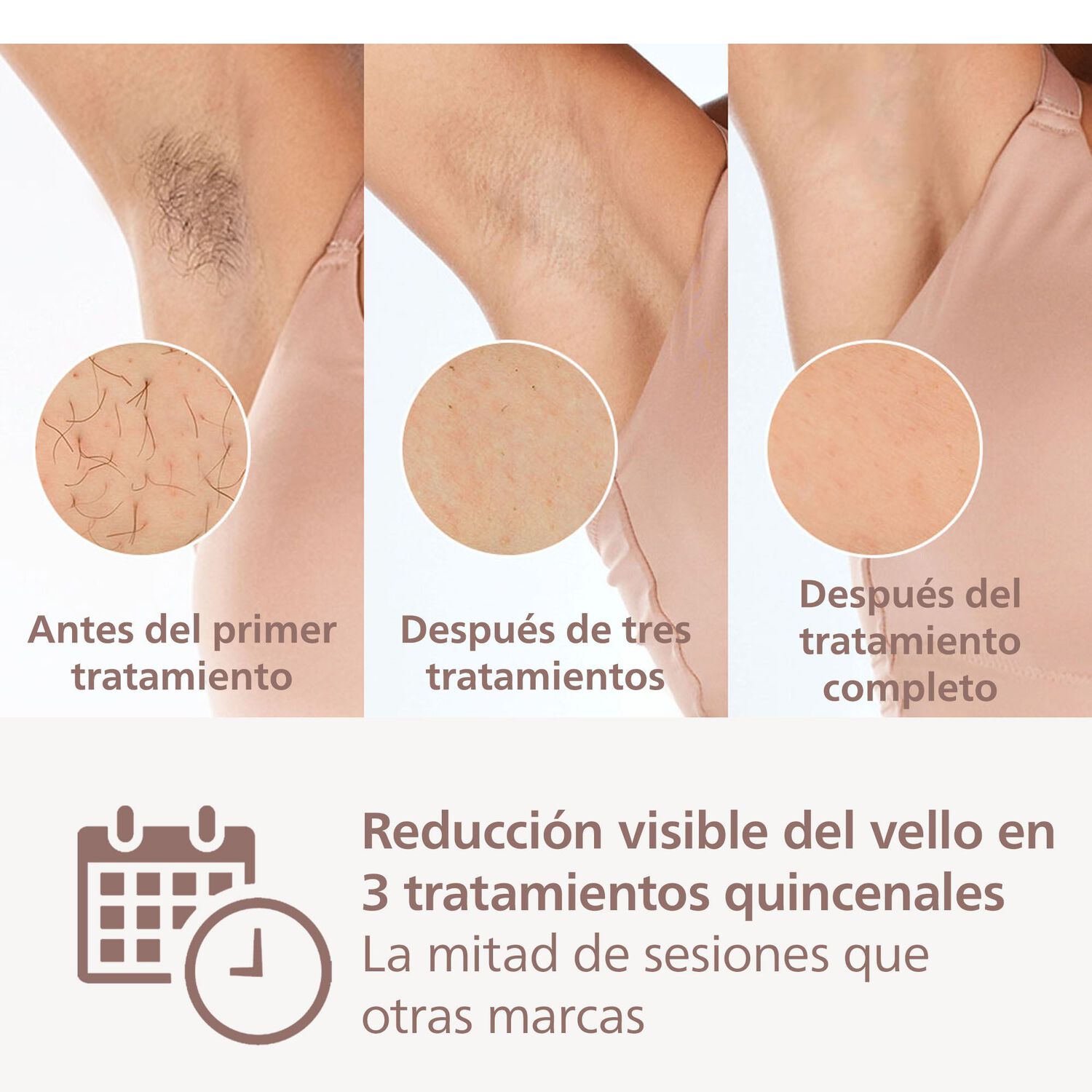 Depiladora IPL Philips Lumea Prestige BRI947 image number 2.0