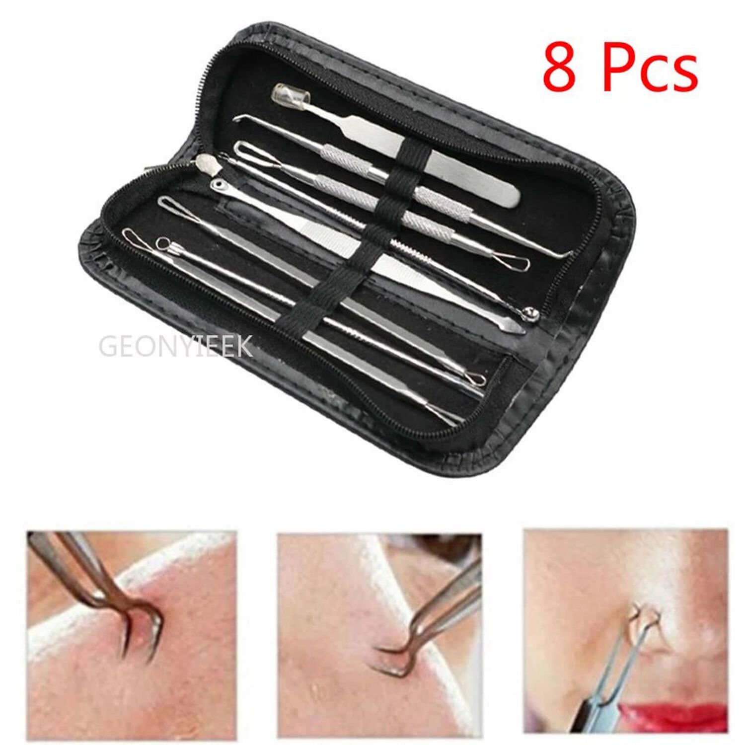 Kit Pinzas Herramientas Removedor Acne Puntos Negros Extractor 8 Piezas image number 3.0