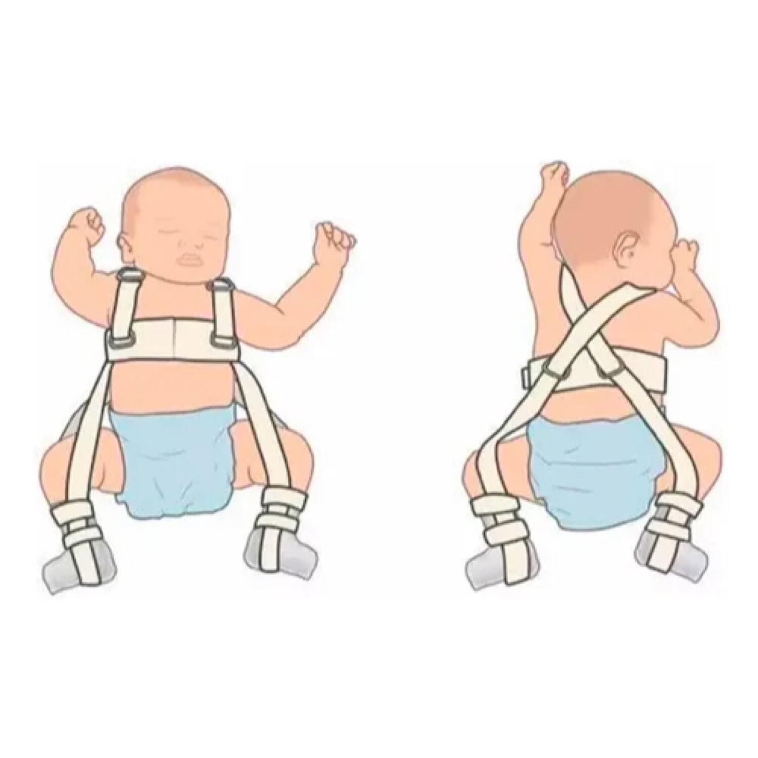 Correas De Pavlik Displasia De Cadera Para Ni&ntilde;os Pedi&aacute;trico image number 4.0