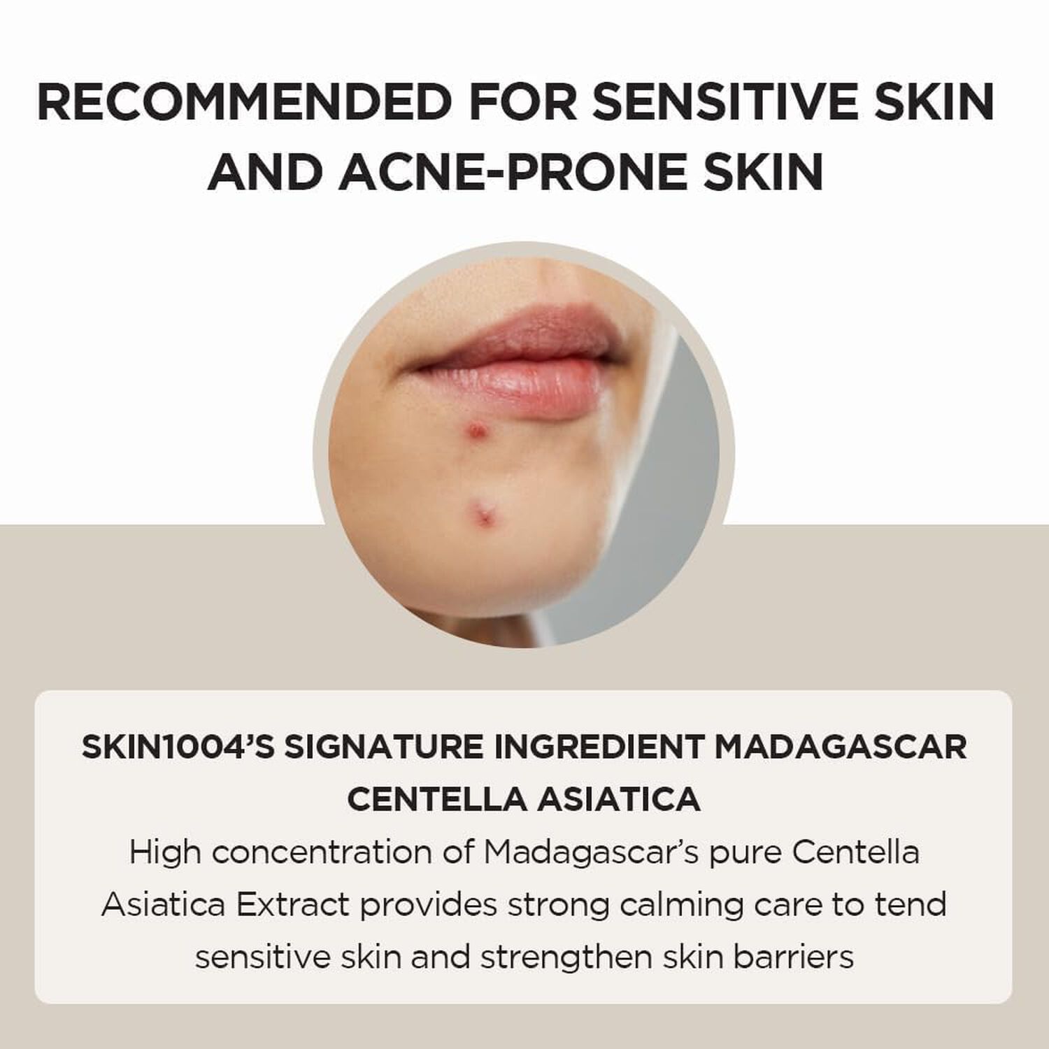 Madagascar Centella Ampoule (skin1004) - 30ml Serum 100% Centella Asi&aacute;tica image number 3.0
