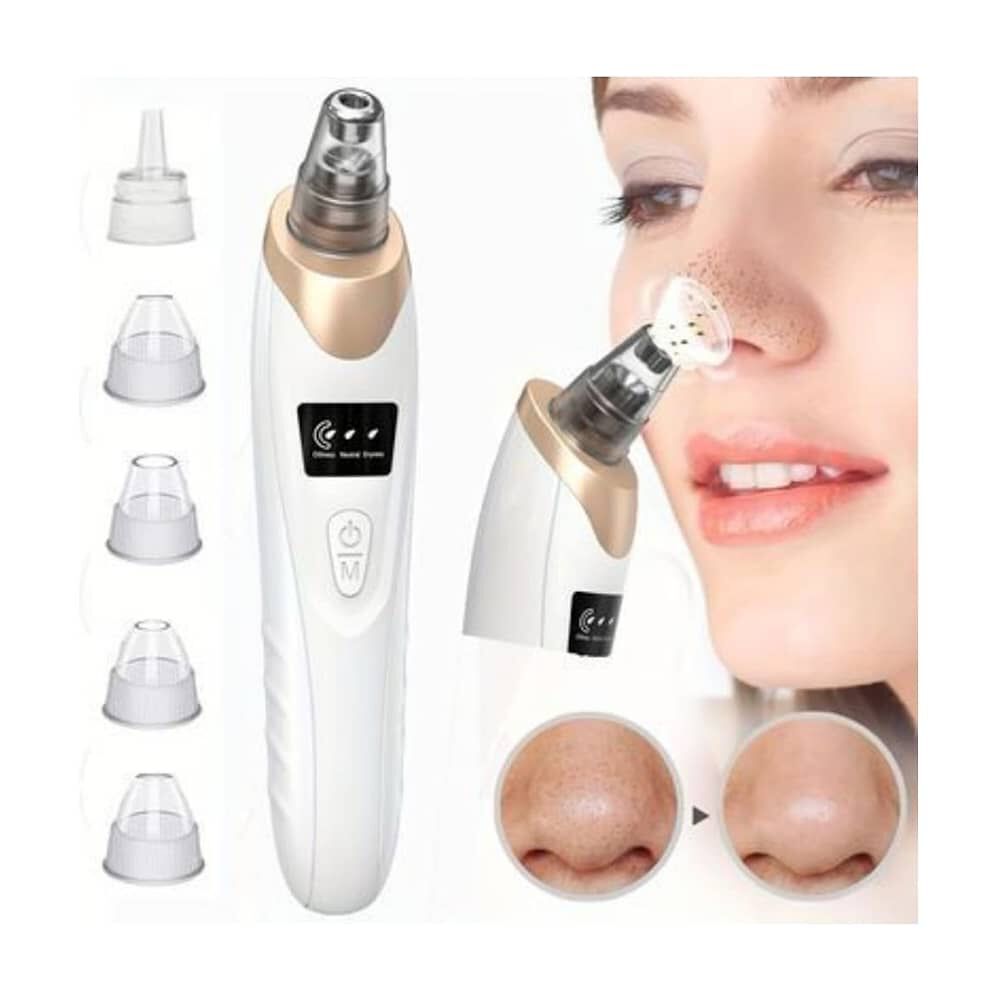 Extractor De Puntos Negros image number 0.0