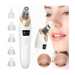 Extractor De Puntos Negros